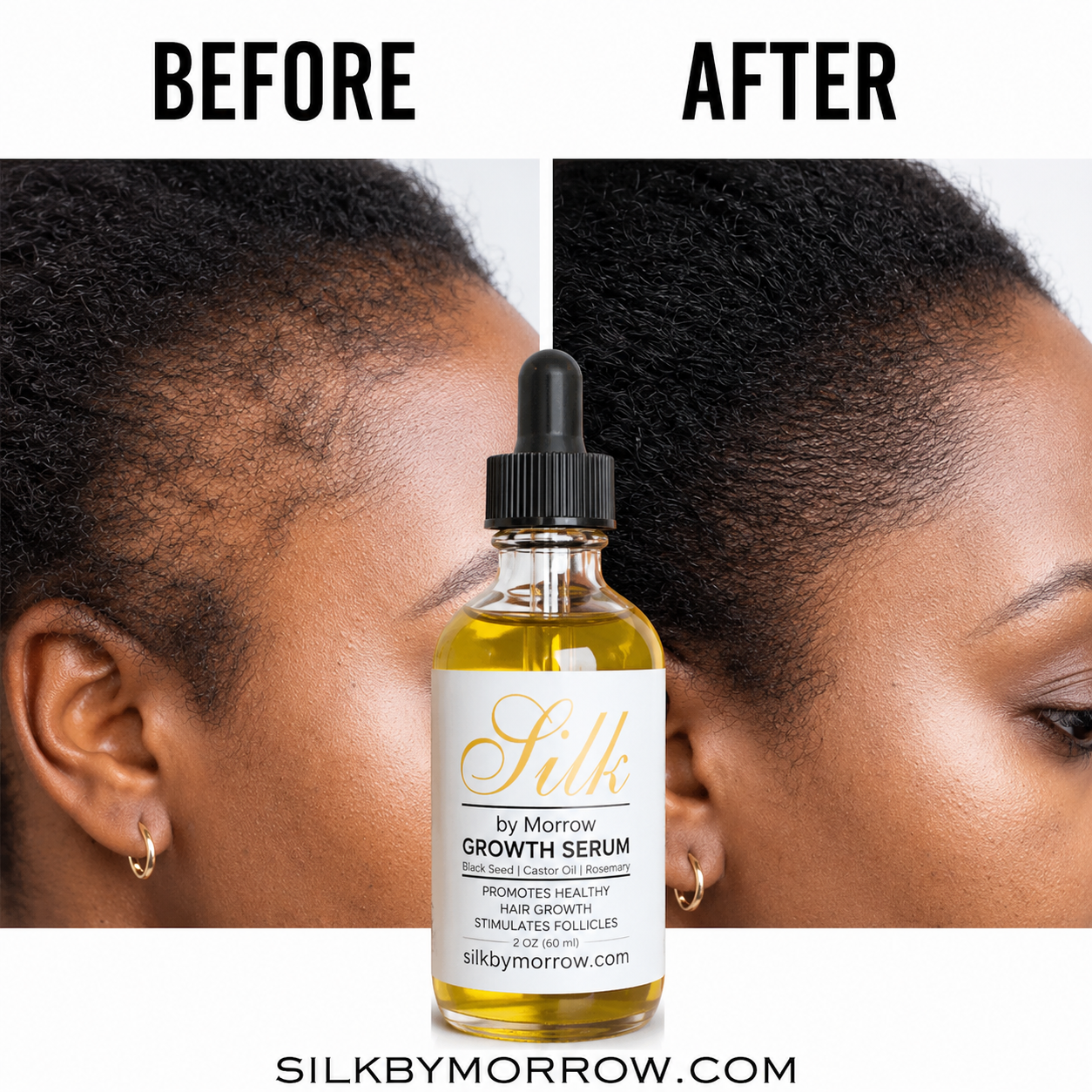 Growth Stimulating Oil Serum